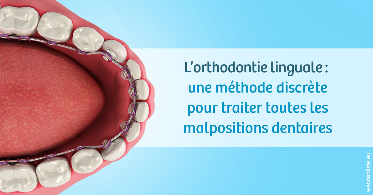 https://dr-cardinaux-laurent.chirurgiens-dentistes.fr/L'orthodontie linguale 1