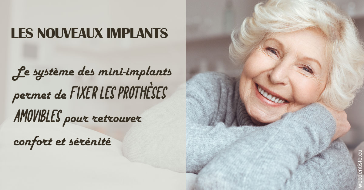https://dr-cardinaux-laurent.chirurgiens-dentistes.fr/Les nouveaux implants 1