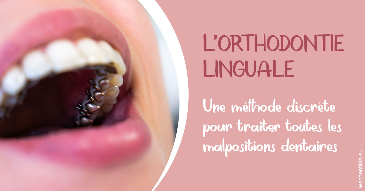https://dr-cardinaux-laurent.chirurgiens-dentistes.fr/L'orthodontie linguale 2