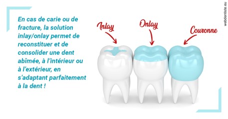 https://dr-cardinaux-laurent.chirurgiens-dentistes.fr/L'INLAY ou l'ONLAY