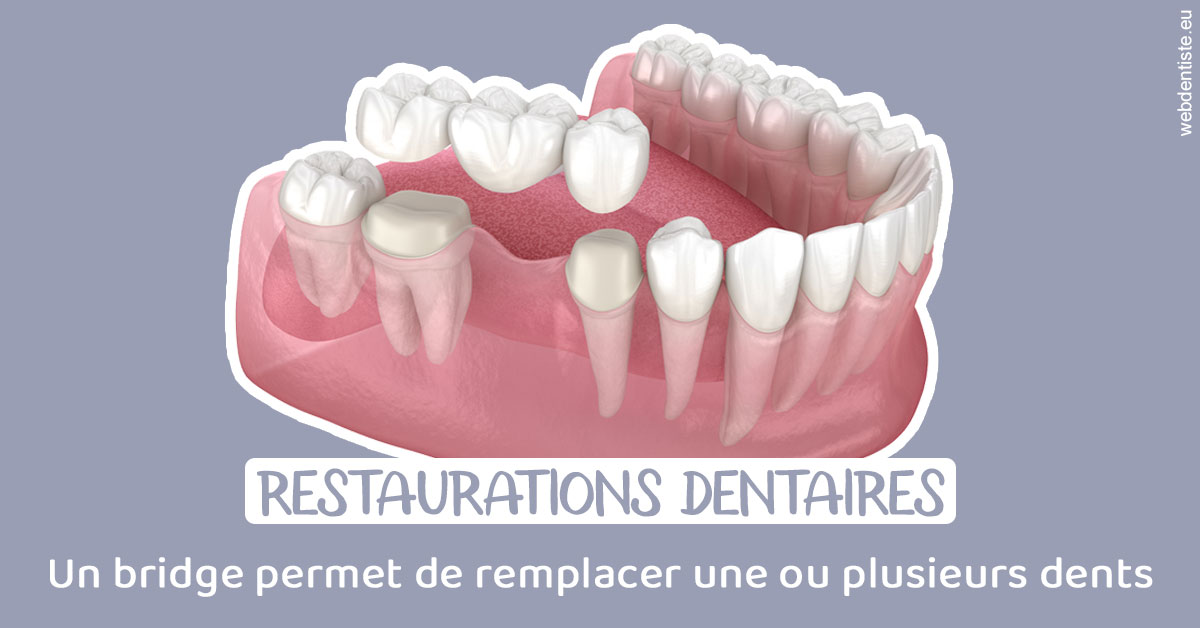 https://dr-cardinaux-laurent.chirurgiens-dentistes.fr/Bridge remplacer dents 1