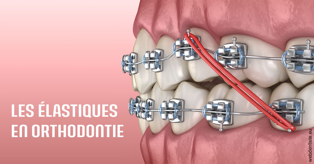https://dr-cardinaux-laurent.chirurgiens-dentistes.fr/Elastiques orthodontie 2