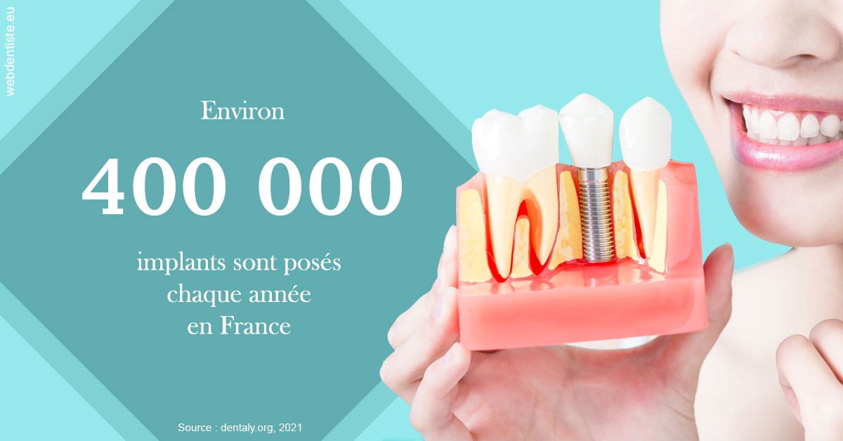 https://dr-cardinaux-laurent.chirurgiens-dentistes.fr/Pose d'implants en France 2